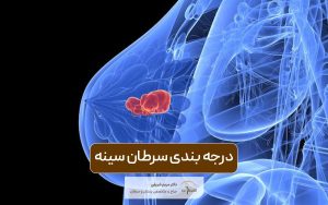 درجه بندی سرطان سینه + انواع گرید بندی سرطان پستان در زنان