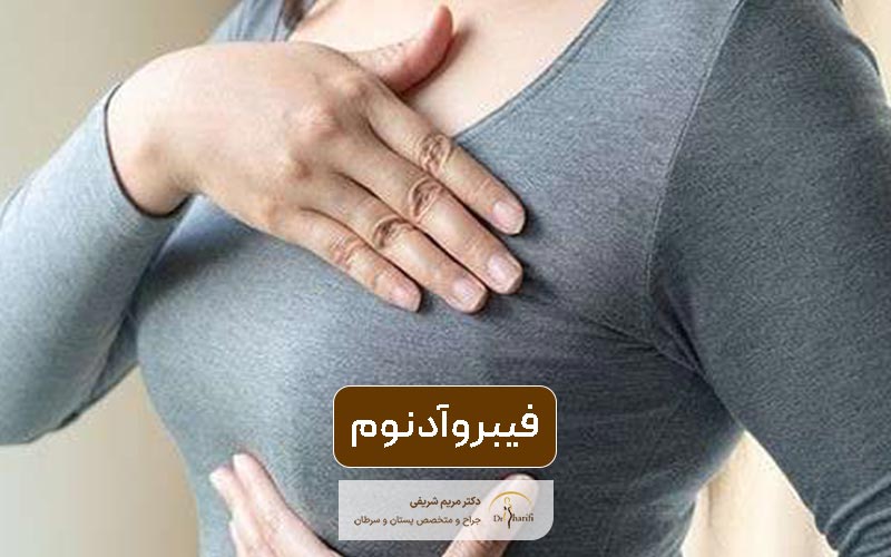 فیبروآدنوم چیست؟ معرفی راه ها و روش های درمان فیبرو آدنوم و دارو برای آن