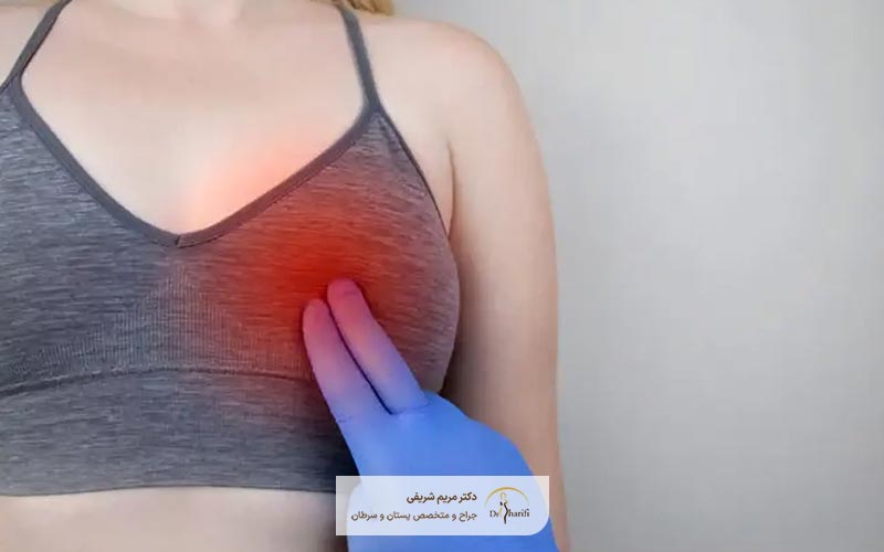 انواع توده فیبروآدنوم سینه و پستان در زنان