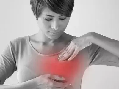 ماستیت گرانولوماتوز دکتر مریم شریفی