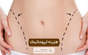 هزینه لیپوماتیک در سال 1404 و عوامل موثر بر قیمت آن