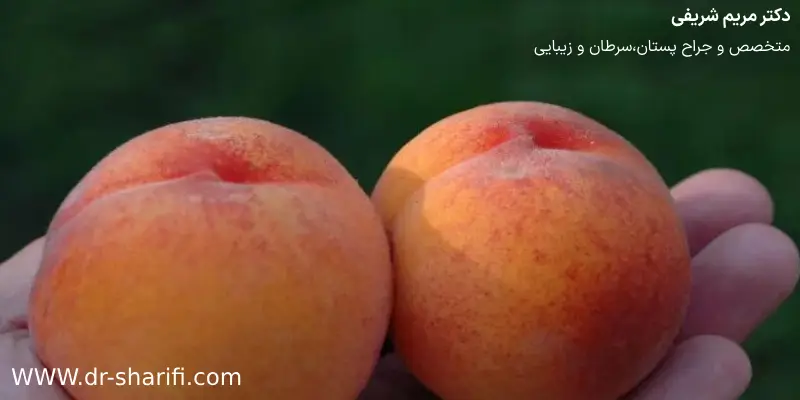 عمل لیپوماتیک ساعت شنی