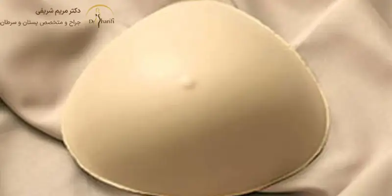 ماندگاری پروتز سینه
