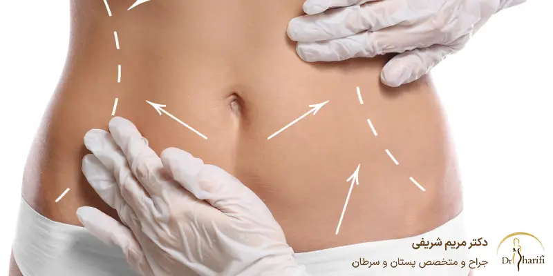 اقدامات بعد از لیپوماتیک شامل چه مواردی می_شود؟