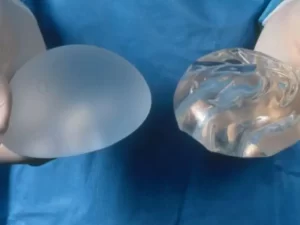 بهترين برند پروتز سينه کدام است؟
