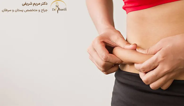 کاندید برای ابدومینوپلاستی