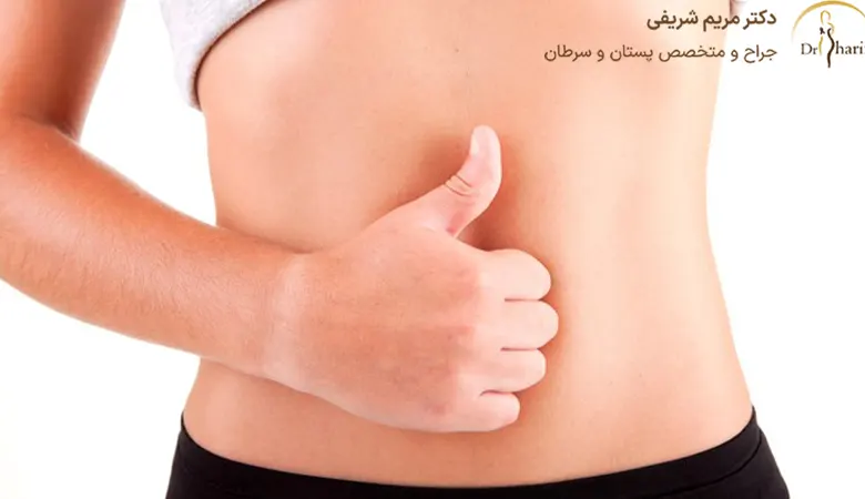 کاندید برای ابدومینوپلاستی