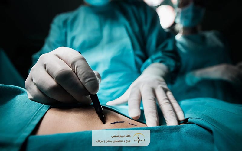 بهترین جراح ابدومینوپلاستی در تهران چه ویژگی هایی دارد