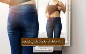 ورم بعد از ابدومینوپلاستی و میزان دوران نقاهت آن در هفته های متوالی