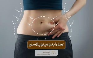 عمل ابدومینوپلاستی (تامی تاک) یا جراحی زیبایی شکم و انواع آن
