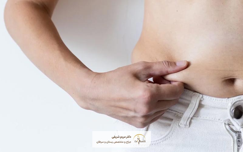 روش های عمل مینی ابدو کدام است