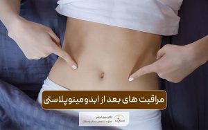 مراقبت های بعد از ابدومینوپلاستی و نکات مهم مراقبتی بعد از تامی تاک یا جراحی زیبایی شکم