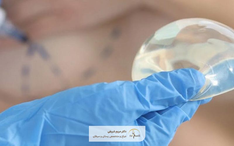 قیمت و هزینه پروتز سالینی سینه در سال 1404 در شهر تهران