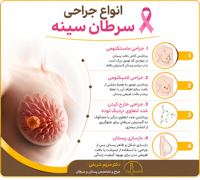 انواع مختلف جراحی سینه
